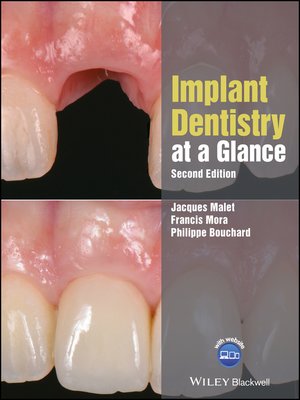 cover image of Implant Dentistry at a Glance